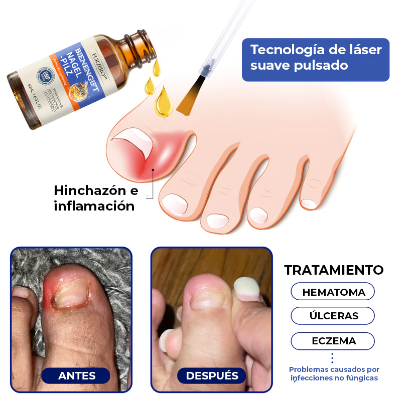 [2X1] |ELIMINA LOS HONGOS DE LAS UÑAS EN 5 DÍAS Y EVITA QUE APAREZCAN PARA SIEMPRE